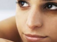 Khám phá cách trị thâm quầng mắt chỉ sau 2 tuần