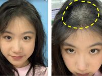 Top 6 Bí Quyết Giúp Phụ Nữ Cải Thiện Tình Trạng Rụng Tóc Và Kích Thích Mọc Tóc