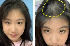 Top 6 Bí Quyết Giúp Phụ Nữ Cải Thiện Tình Trạng Rụng Tóc Và Kích Thích Mọc Tóc