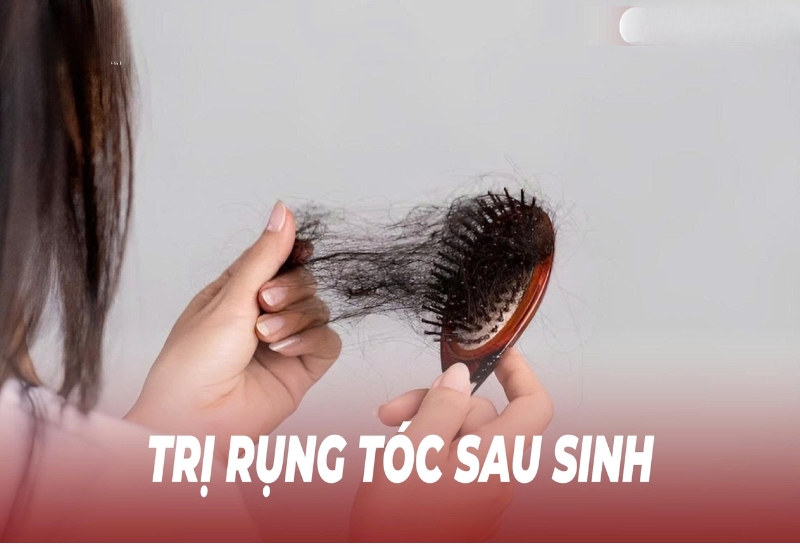 Trị rụng tóc sau sinh