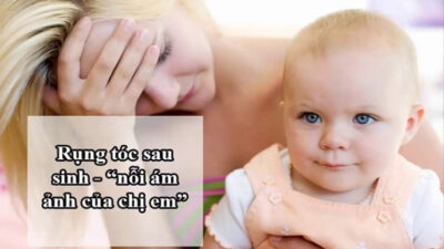 cach-tri-rung-toc-sau-sinh