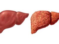 XƠ GAN VÀ MỘT SỐ THÔNG TIN CẦN BIẾT