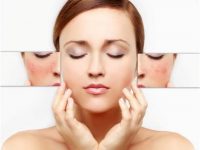 Lời khuyên chọn sản phẩm trị nám hiệu quả từ chuyên gia