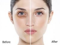 Phương pháp trị thâm quầng mắt siêu hiệu quả với bột trà xanh