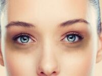 Cách Trị Thâm Quầng Mắt Lâu Năm Triệt Để Tại Nhà